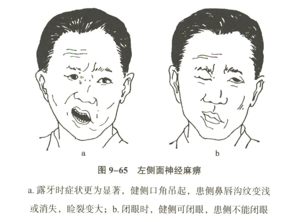 神经系统