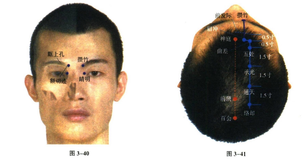 针灸学