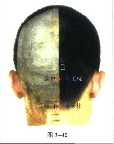 针灸学