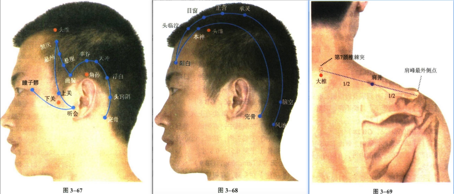 针灸学