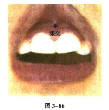针灸学