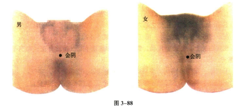 针灸学