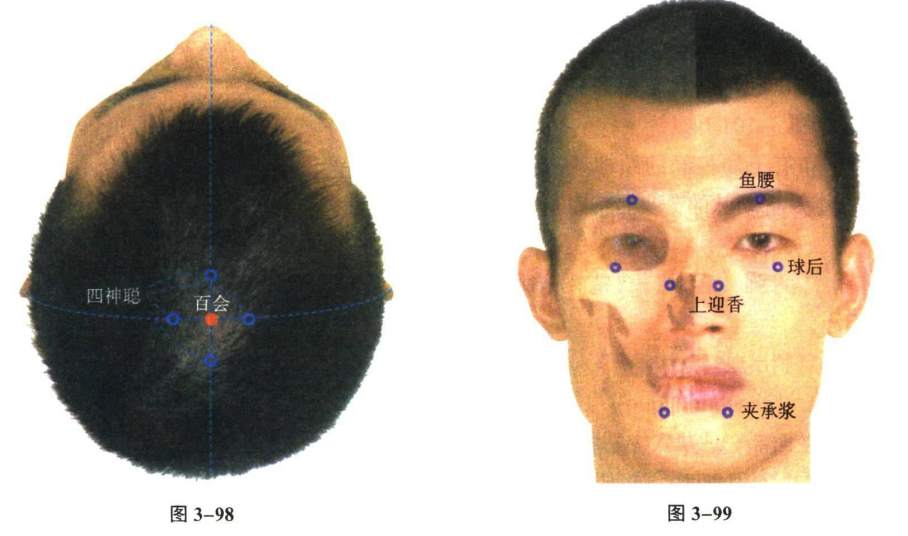 针灸学