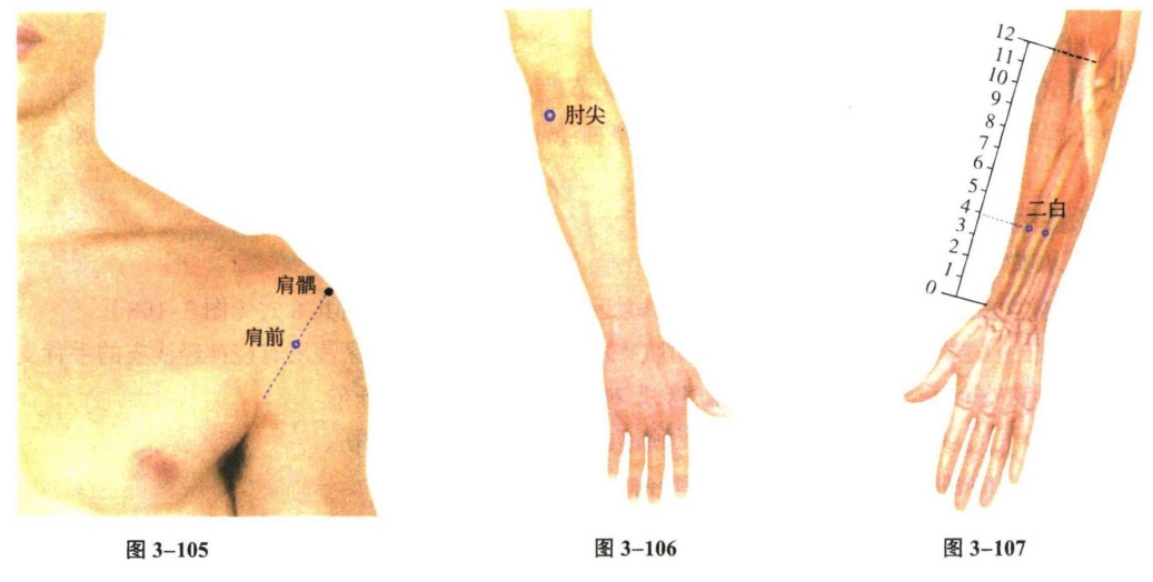 针灸学