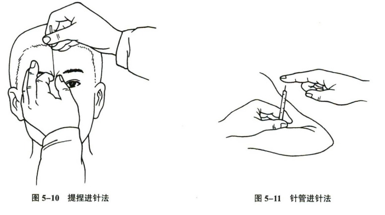 针灸学