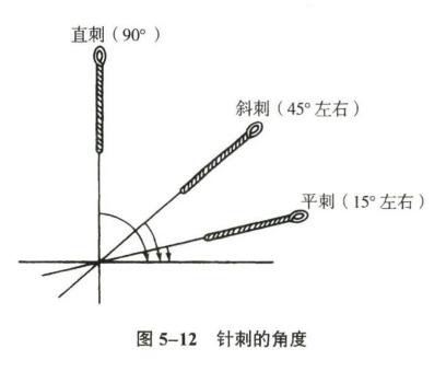针灸学
